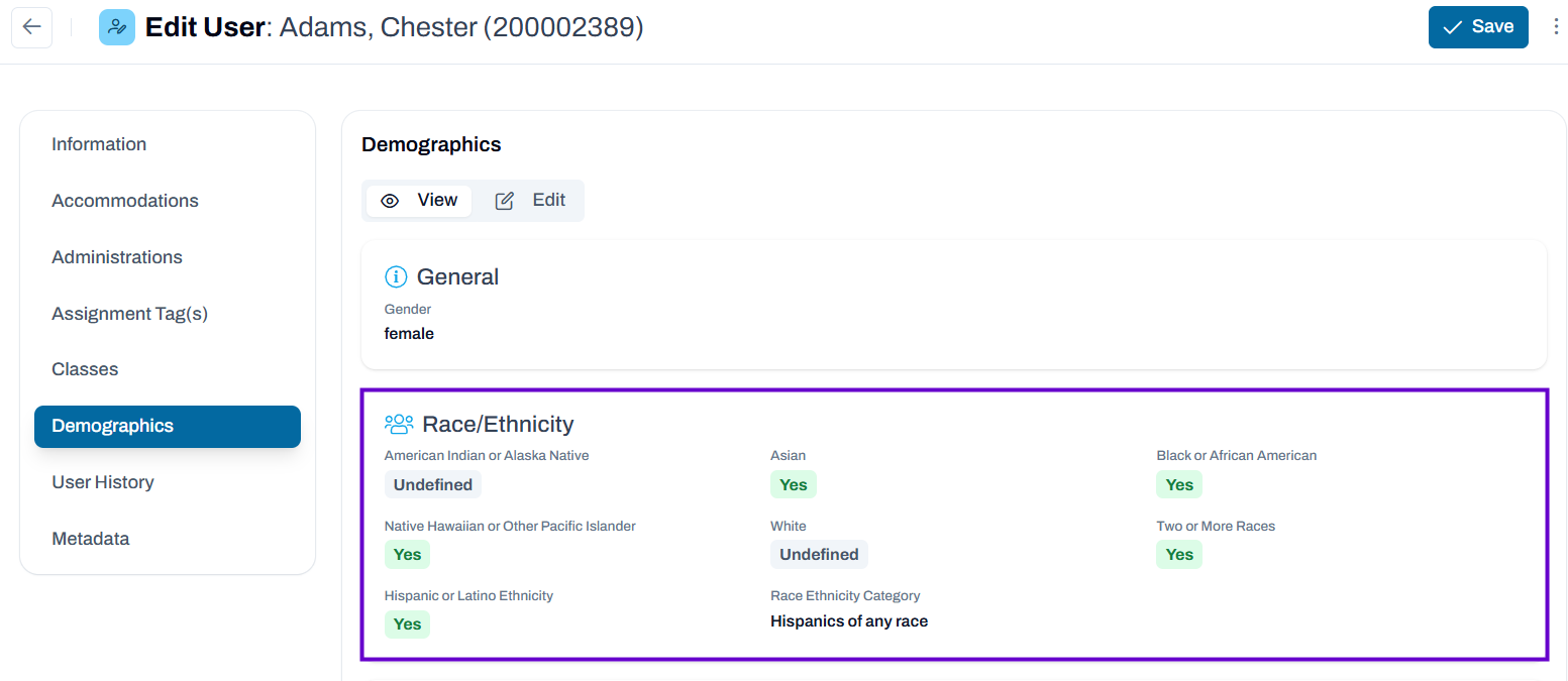 Sample Race Ethnicity view and edit screens.